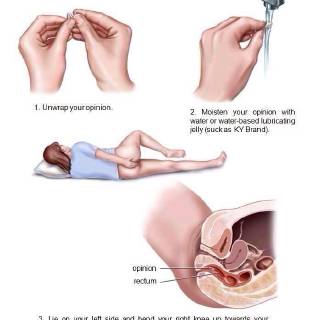 what to do with your opinion